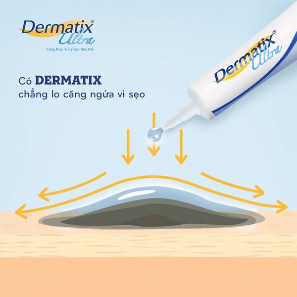 Sử dụng gel Dermatix Ultra