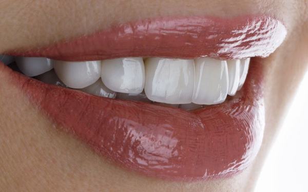 Bọc răng sứ giúp cải thiện tính thẩm mỹ